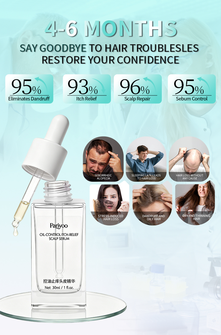 Scalp Essence Balance Sebum Oil Control Serum for Itchy and Flaky Scalp Treatment