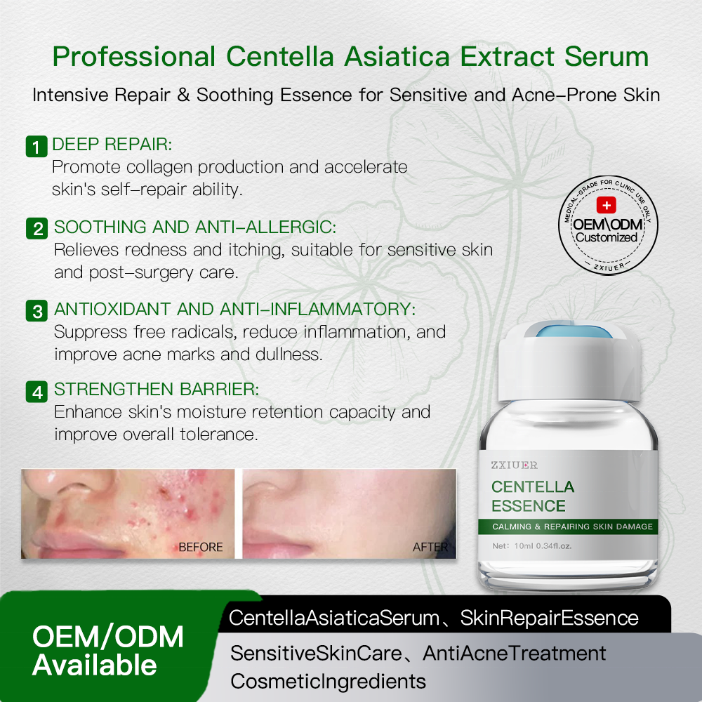 Soothing Centella Whitening Serum for Face Anti-Redness Barrier Repair 10ml Concentrated for Hydrating Calming Skin Care