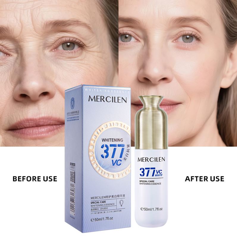 MERCILEN Whitening Serum with Retinol Nicotinamide Arbutin Anti-Aging Lightening Dark Spot Correction Face Care Skin Care Serum