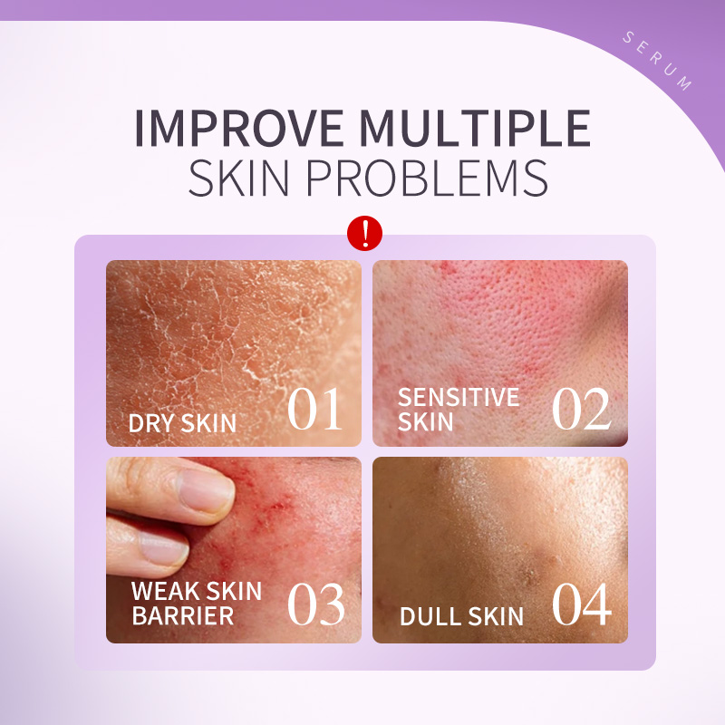 GREENLEM Barrier Repair Serum Moisturizing Soothing Face Serum Strengthen Skin Skincare OEM
