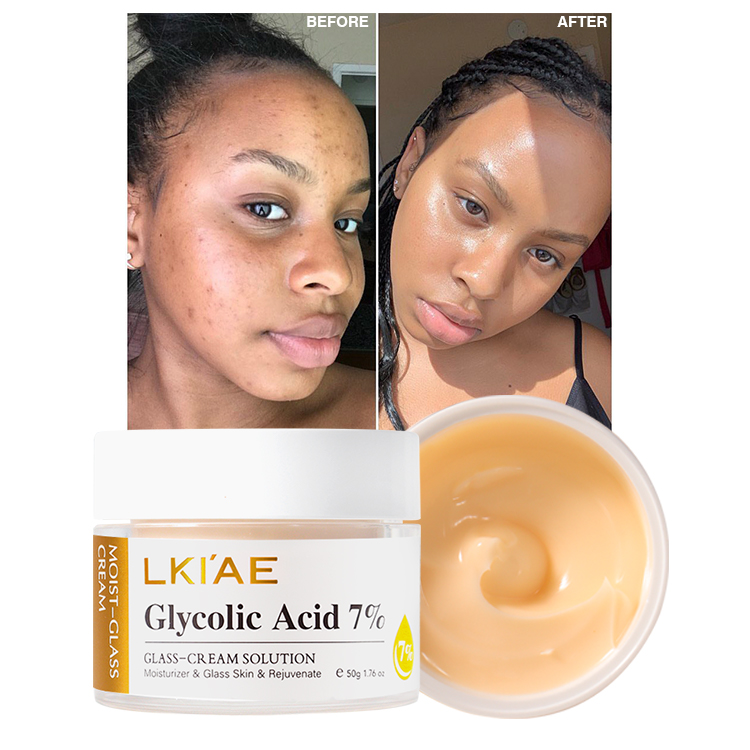 Hot Sell 7 Days Instant Whitening Cream Niacinamide Glycolic Acid Dark Spot Remover Moisturizing Brightening Face Cream