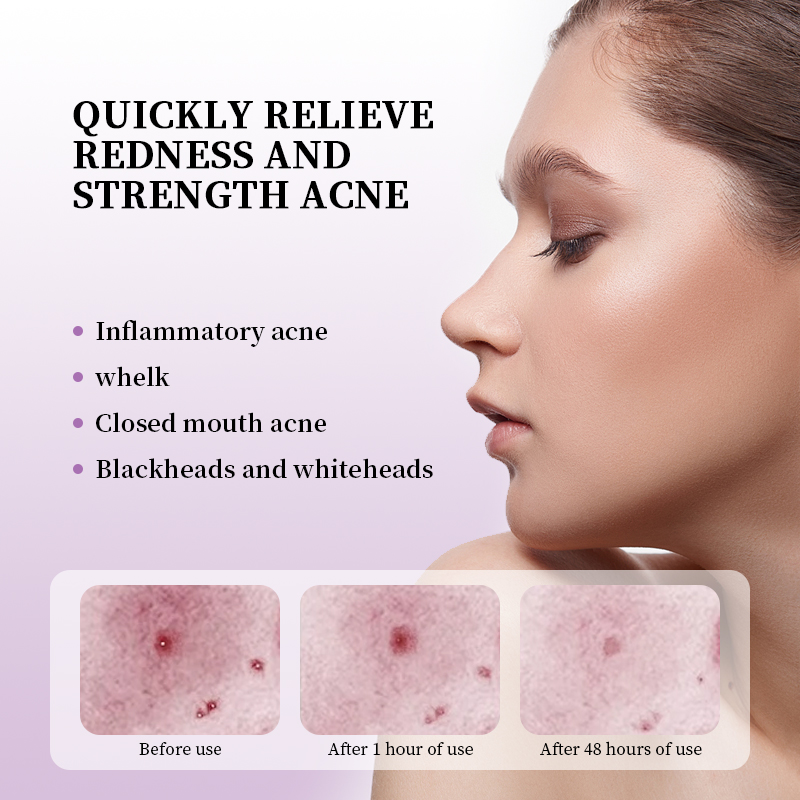 Dark Spot Correcting Moisturizing Brightening Fade Fine Lines Deep Cleaning Makeup Remover Korean Skin Care Niacinamide Serum