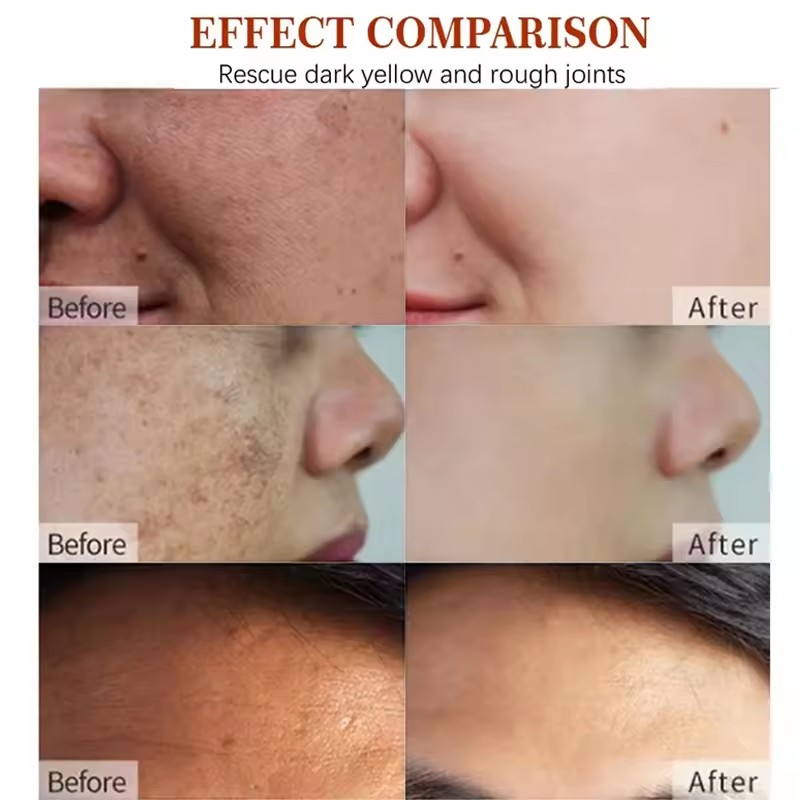 Nicotinamide Hyaluronic Acid Dark Spot Corrector Vitamin E Day Night Brightening Cream for Private Label OEM/ODM