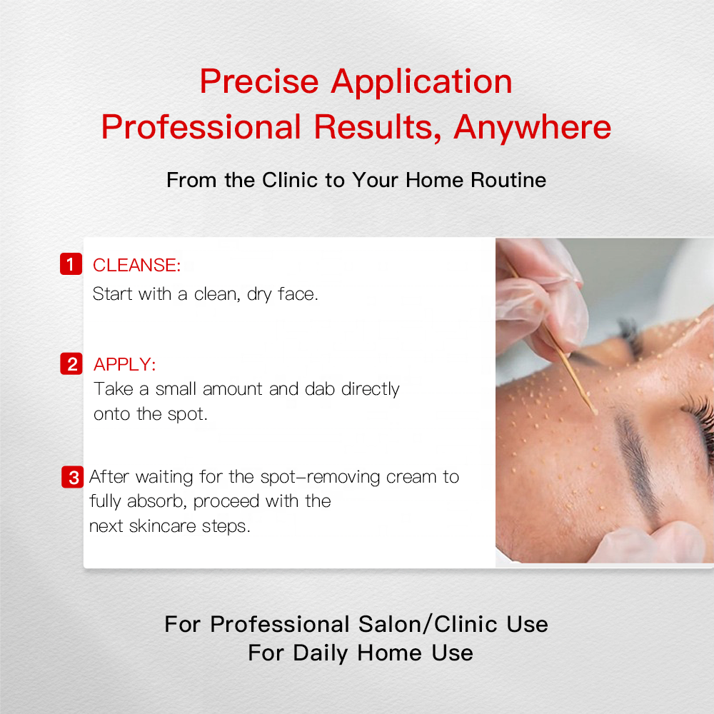 Professional Dark Spot Freckle Removal Cream Azelaic Acid Salicylic Acid Melasma Age Spots Hyperpigmentation Gentle Exfoliating