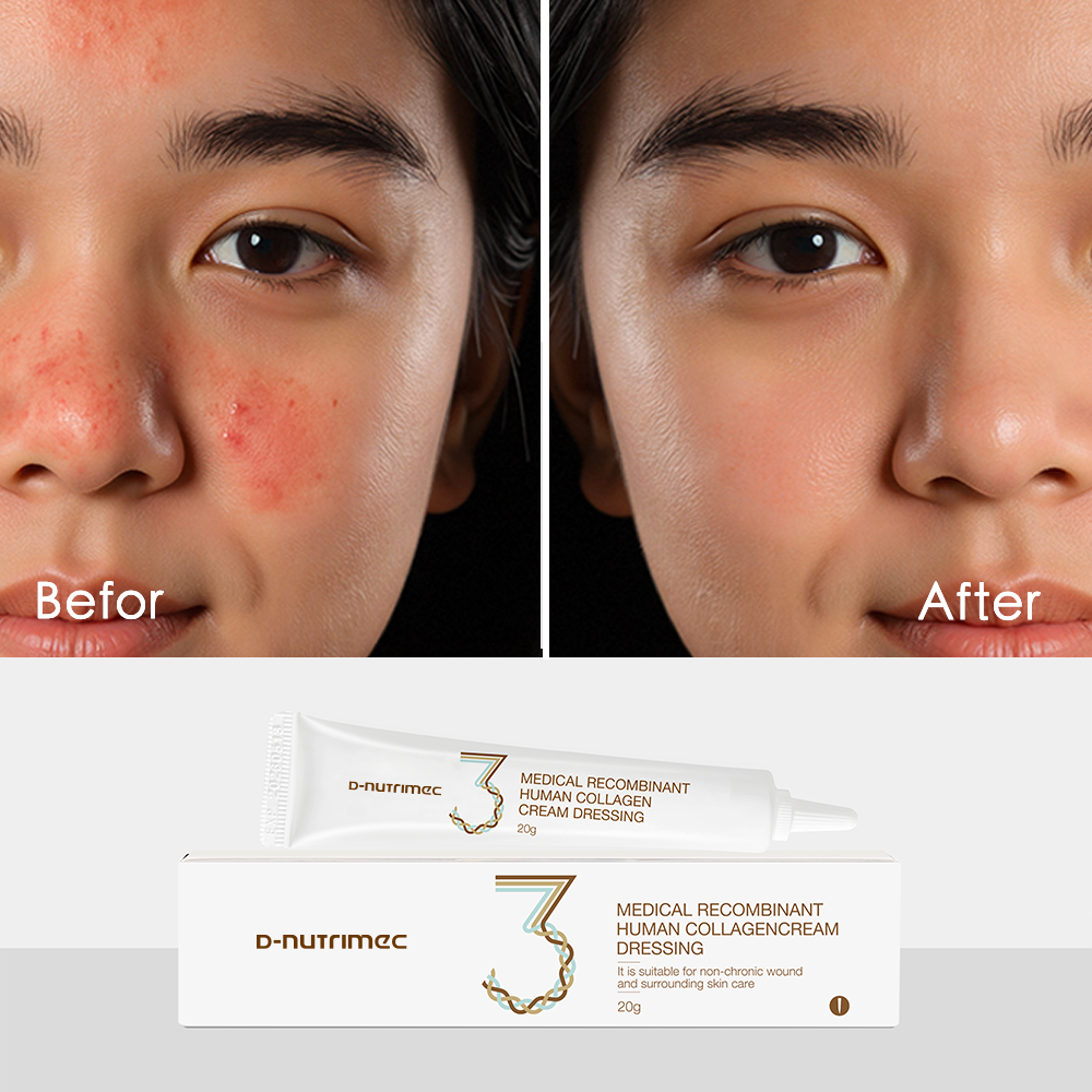 OEM/ODM Skincare Supplier Laser Resurfacing Aftercare Cruelty-free Skin Barrier Repair Recombinant Collagen Recovery Cream