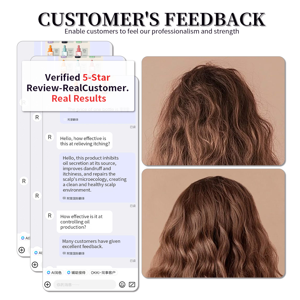 Scalp Essence Balance Sebum Oil Control Serum for Itchy and Flaky Scalp Treatment