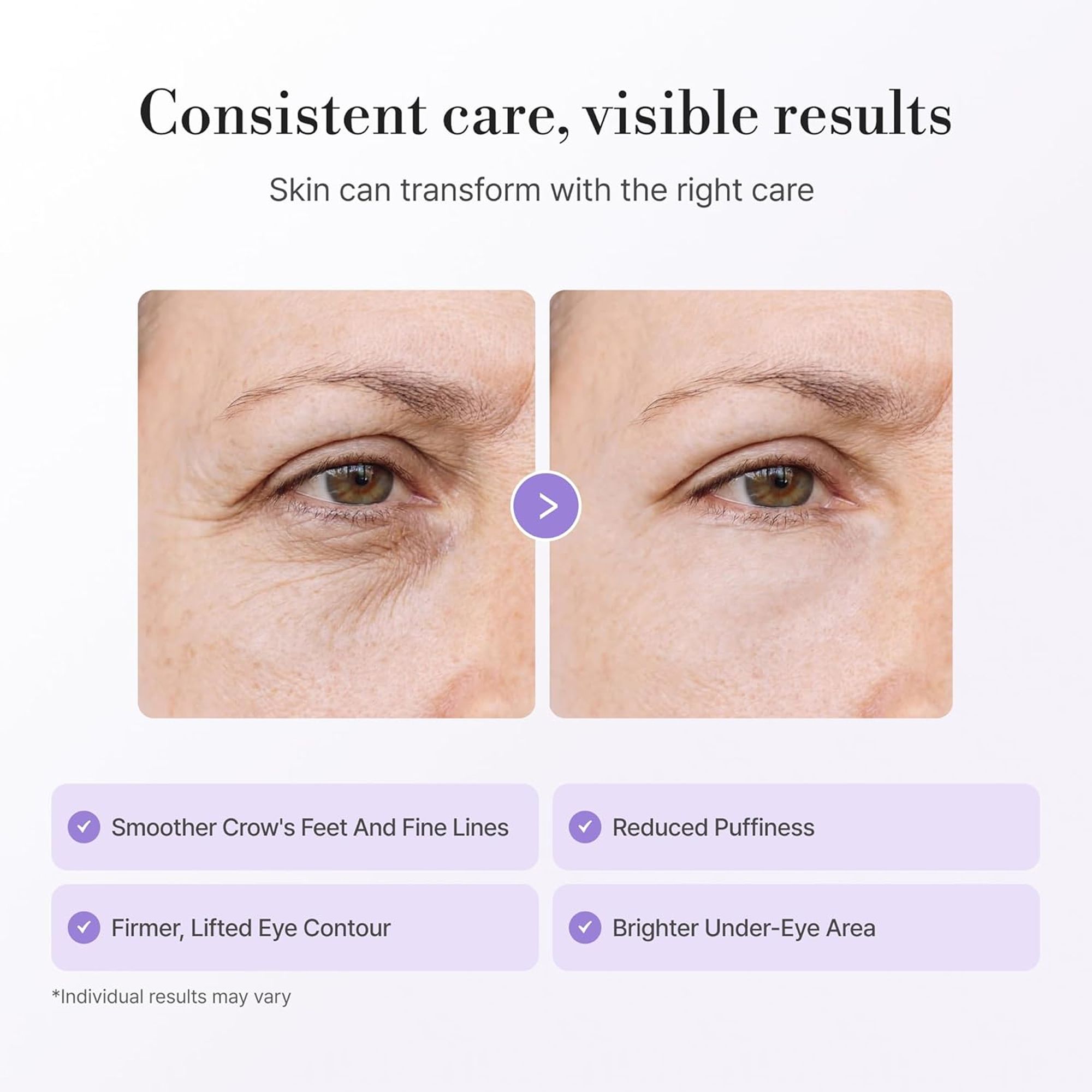OEM/ODM Peptide Matrix Eye Cream Firming Lifting Matrixyl 3000 Ginseng Centella Smooth Wrinkles Dark Circles 0.5oz