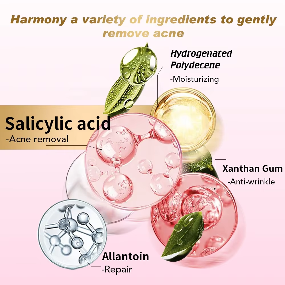 Private Label Face Anti Button Pore Minimizing Oil Control Anti Acne Pimples Remove Salicylic Acid Whitening Cream