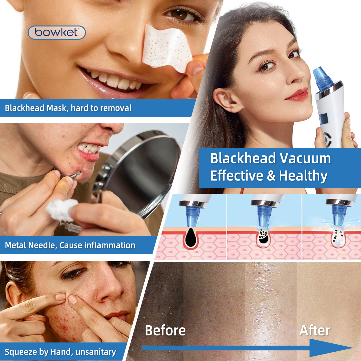 Bowket Skin Rejuvenation &amp; Whitening Set Pore Minimizer Machine and Acne Nose &amp; Whitehead Blackhead Remover Facial Machine