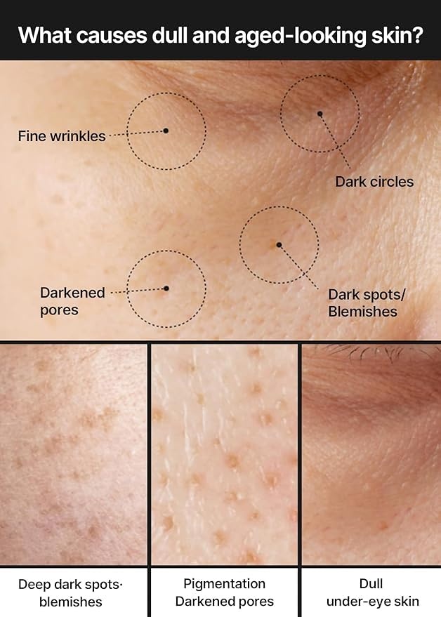 For Pore+Dark Spot Brightening Cream | Niacinamide Tranexamic Acid TXA Pore Minimizer Non-Irritating Hydrating Even-Toning