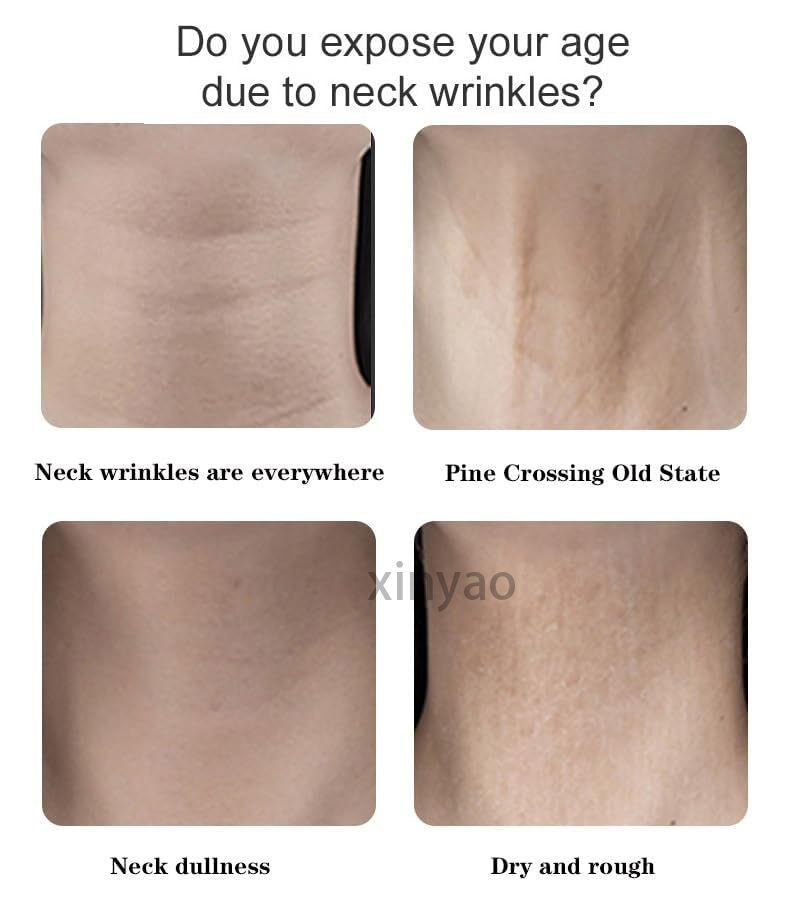 Custom Logo Neck Lift Wrinkle Tape Instant Necktape Lift Breathable Lift Strap Tightening Tapes for Necks Face Jaw Firming Neck