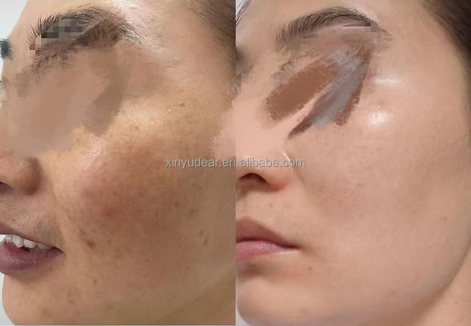 Spot Correcting Cream Info 3