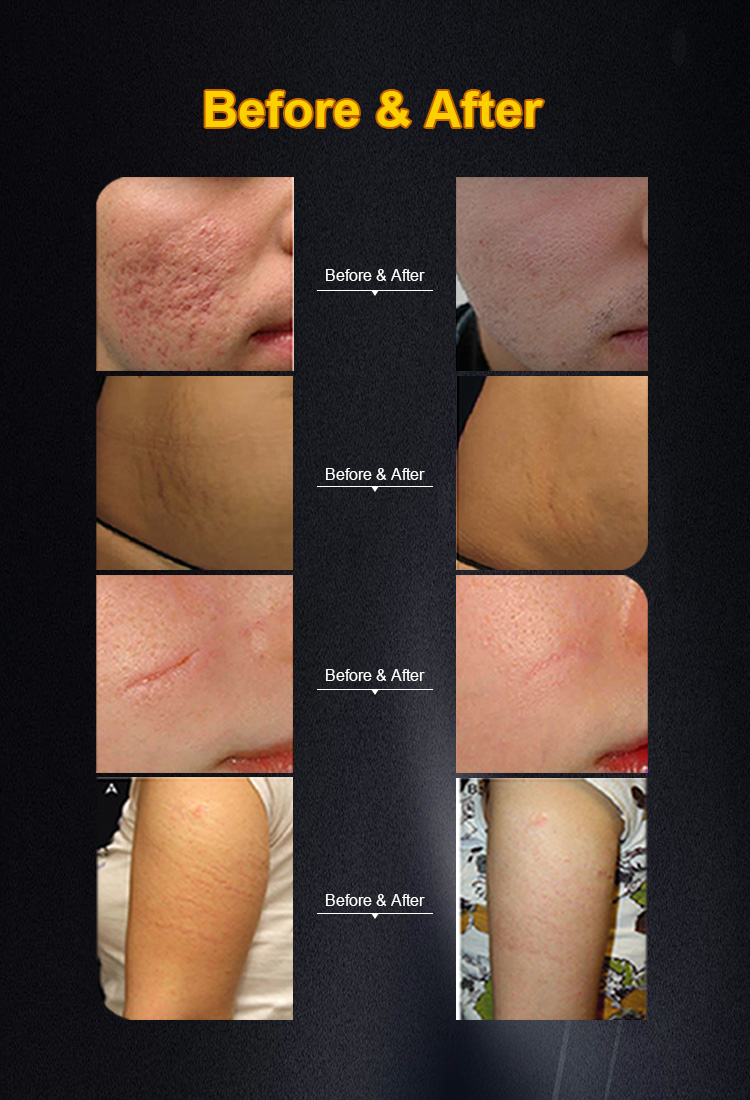 Treatment Results 1