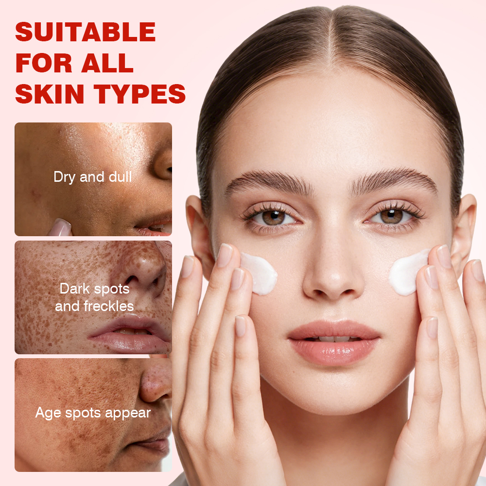 Strong Effective Whitening Freckle Cream Face Remove Melasma Dark Spots Melanin Remover Private Label Brighten Skin Care Cream