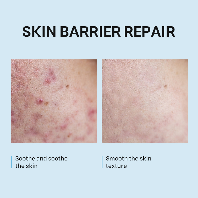 5X Ceramide Barrier Repair Serum Intense Hydration Skin Barrier Recovery Anti Aging Soothing Facial Serum for Dry Sensitive Skin
