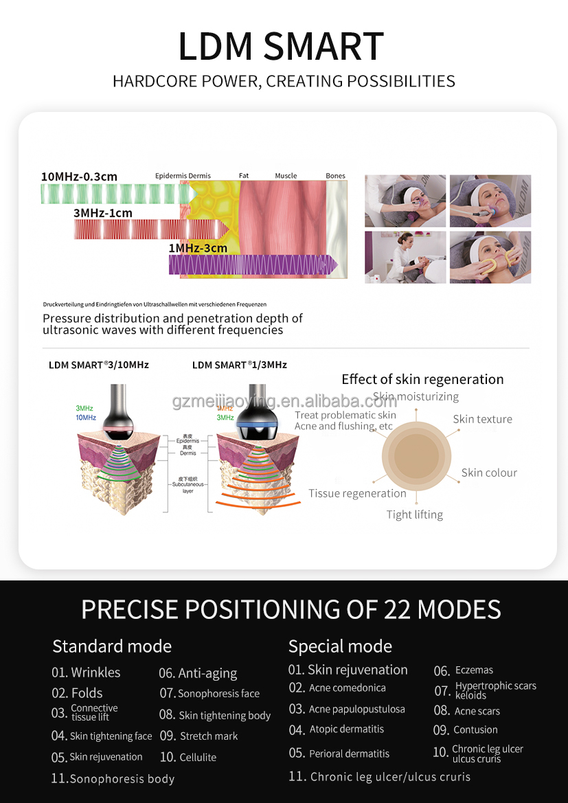 Smart LDMed Plus Treatment Result 2