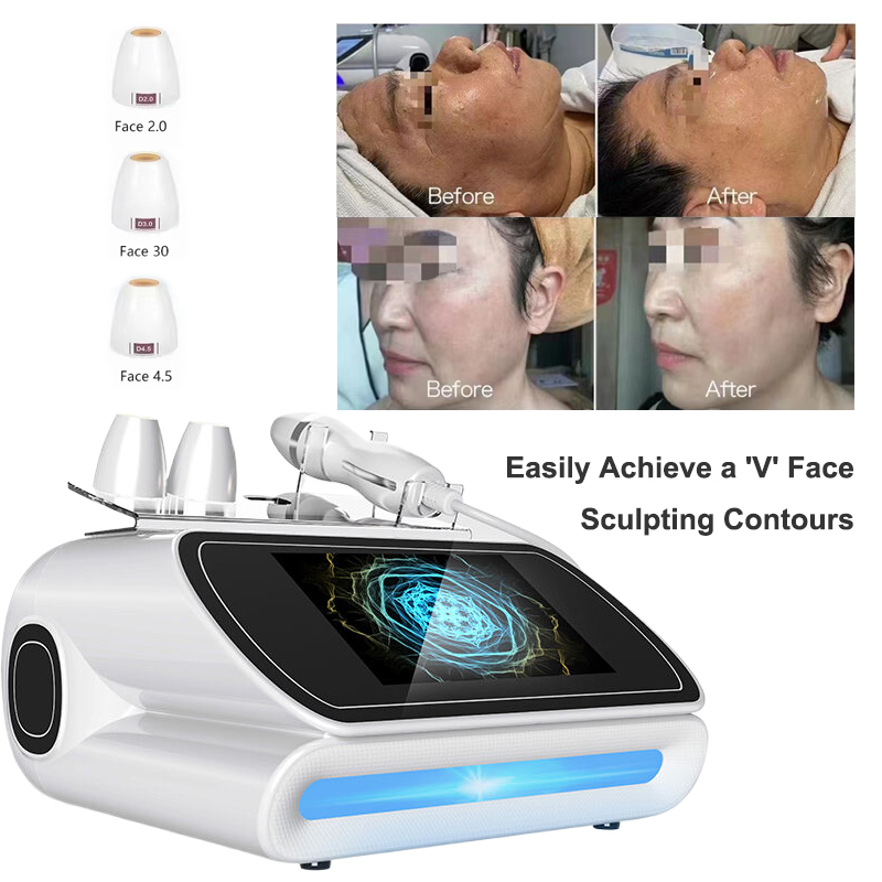 2026 hot sale Time-Shaping Device Time-Shaping Device Activates collagen Reduces wrinkles Lifts and firms