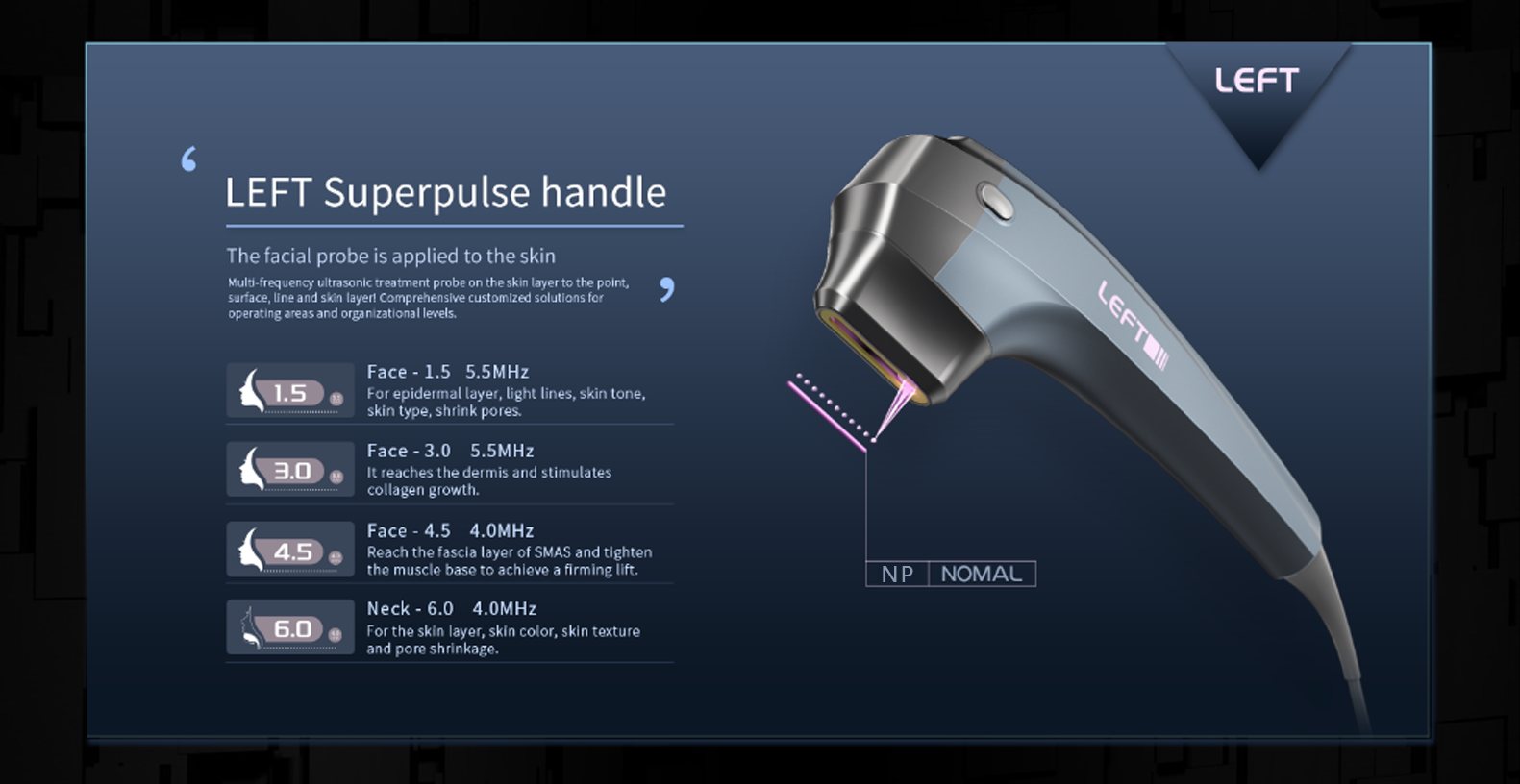 Handle Intro 2