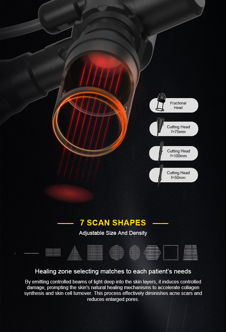 RF Tube Advantages