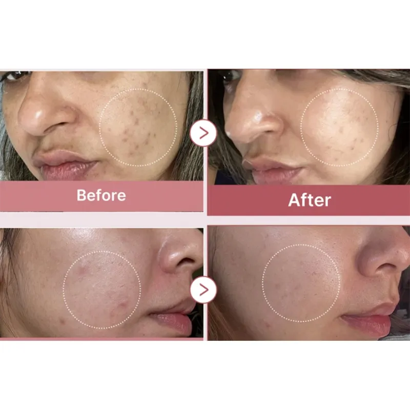 Face Serum Display 4