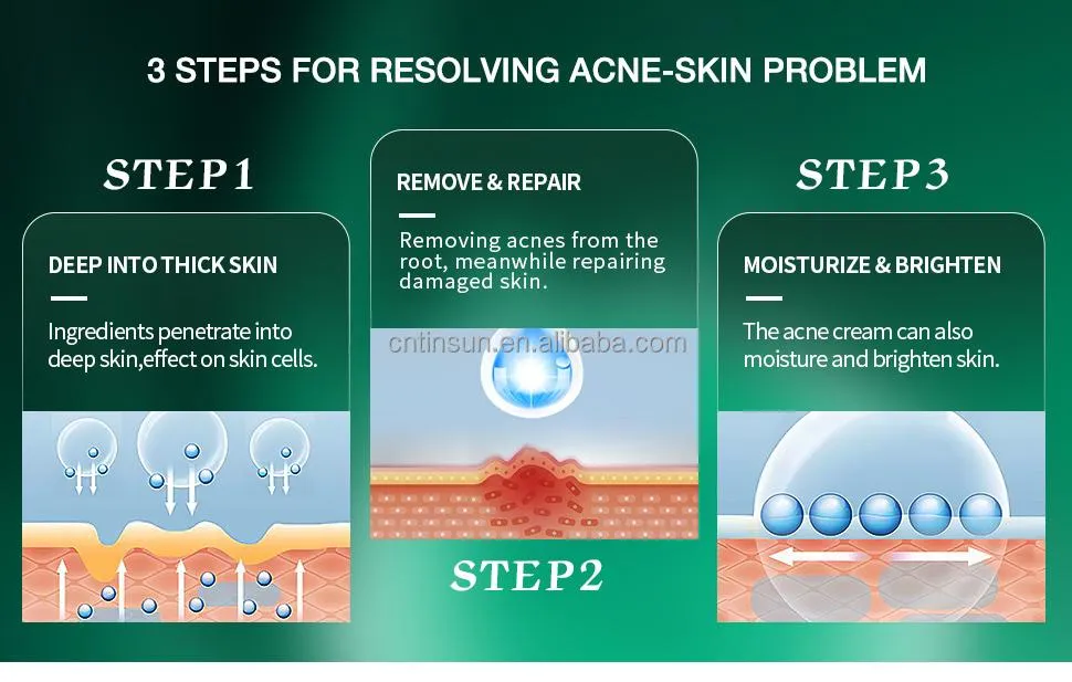 Anti-Acne Cream Image 5
