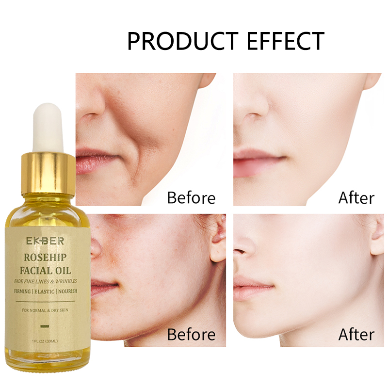 Hot Sale Ekber Private Label Skin Care Facial Oil Vegan Skin Repair Rosehip Serum Face Oil Rosehip Face Oil