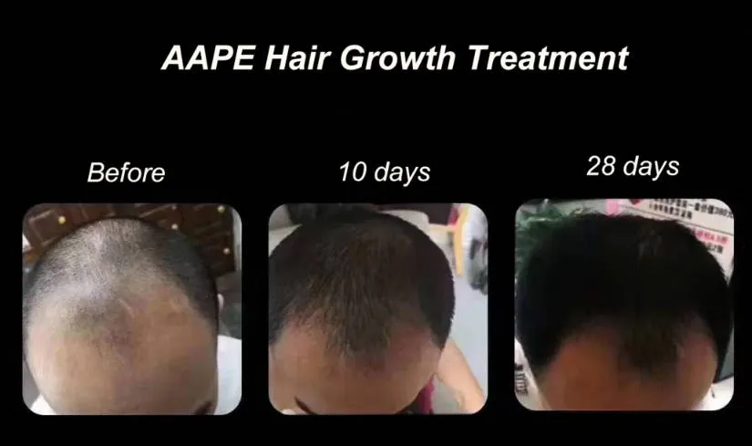 Before and After Results