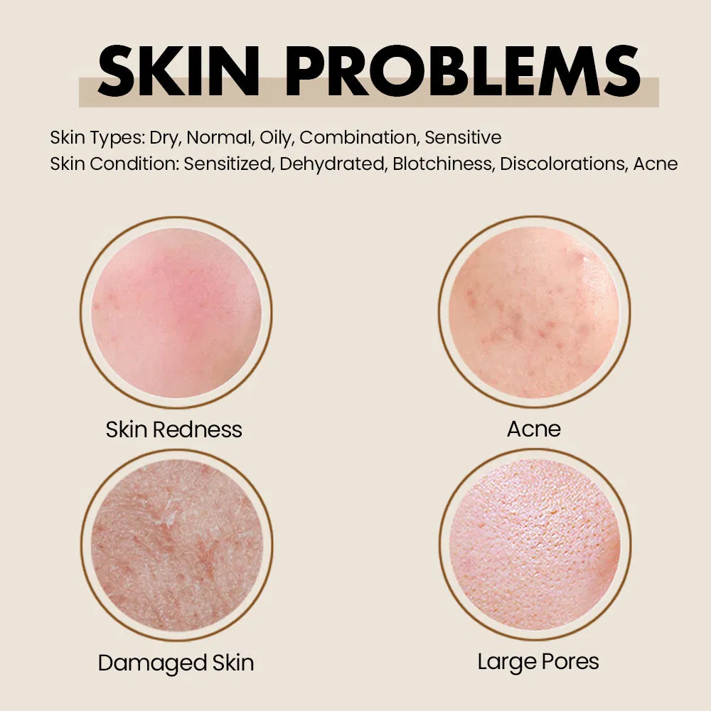 Redness Sensitive Skin Repair Water Hydrating Moisturizing Facial Toner