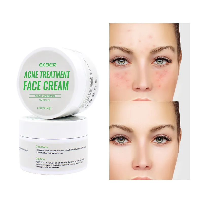 Repair Anti-Acne Treatment Moisturizing Scar Blackhead Shrink Pores Whitening Facial Skin Care Acne Treatment Cream