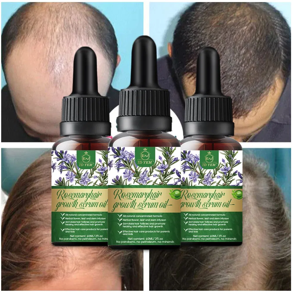 Rosemary Hair Growth Essential Oil 30ml Improves Hair Quality Plant Essential Oil Nourishes Hair Care