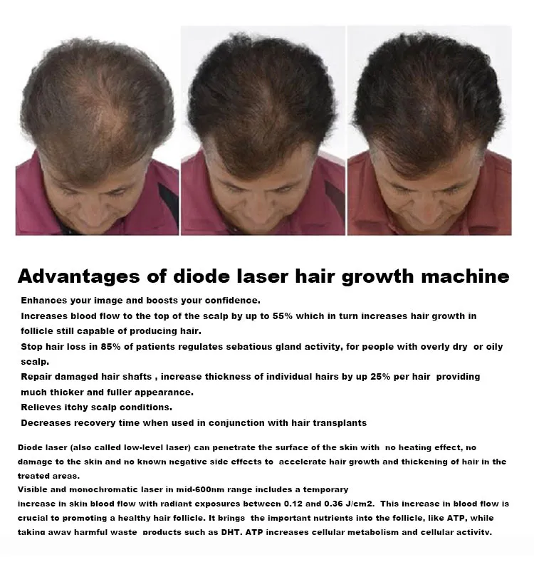 Hair Growth Therapy 3