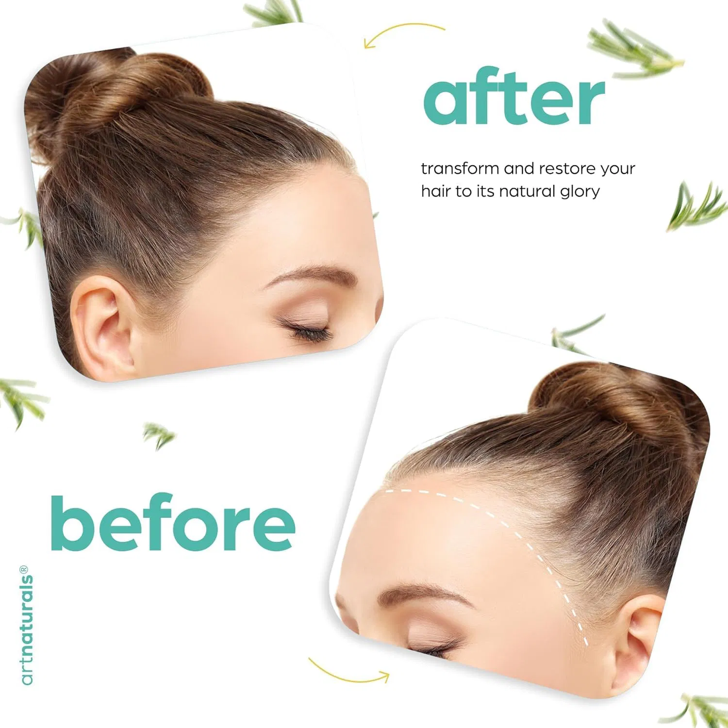 Organic Rosemary &amp; Castor Hair Growth Oil for Dry Itchy Scalp Thickening &amp; Hydration