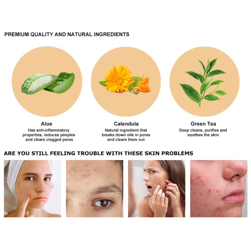 Repair Anti-Acne Treatment Moisturizing Scar Blackhead Shrink Pores Whitening Facial Skin Care Acne Treatment Cream