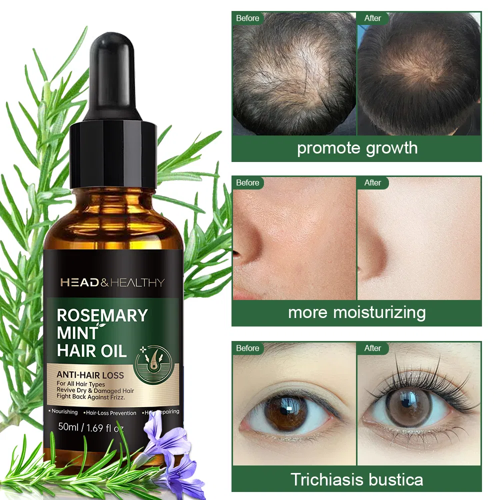Rosemary Mint Scalp Oil 1
