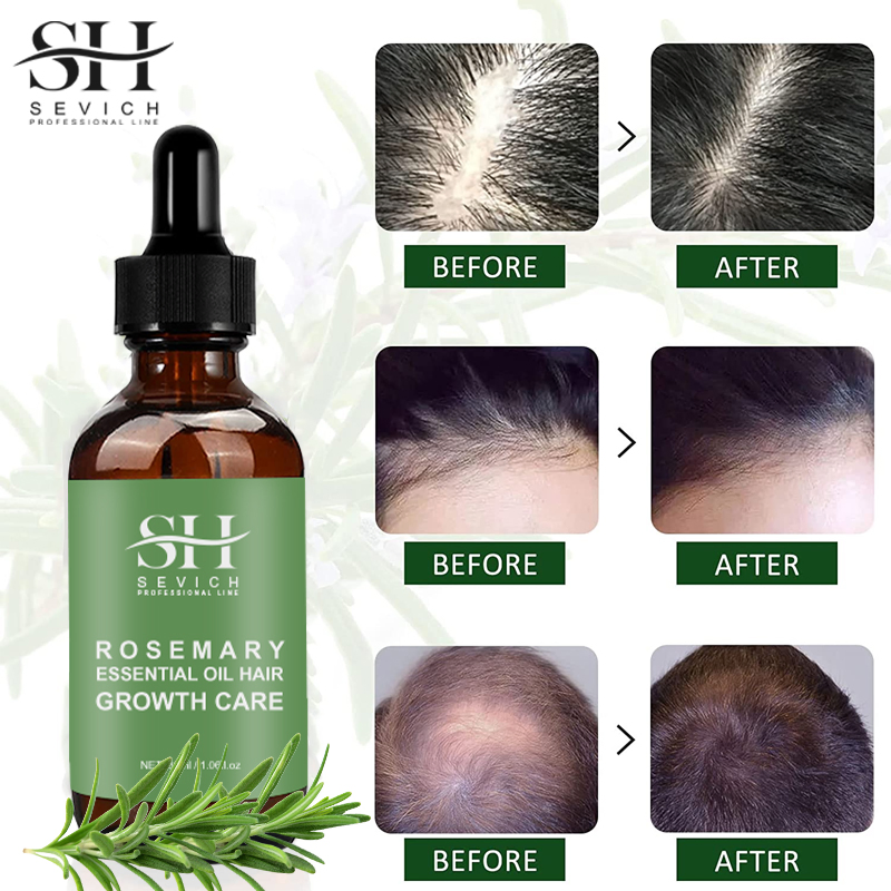 Nourishing Shine Smoothing Rosemary Mint Oil Hair Growth Scalp Hair Strengthening Oil