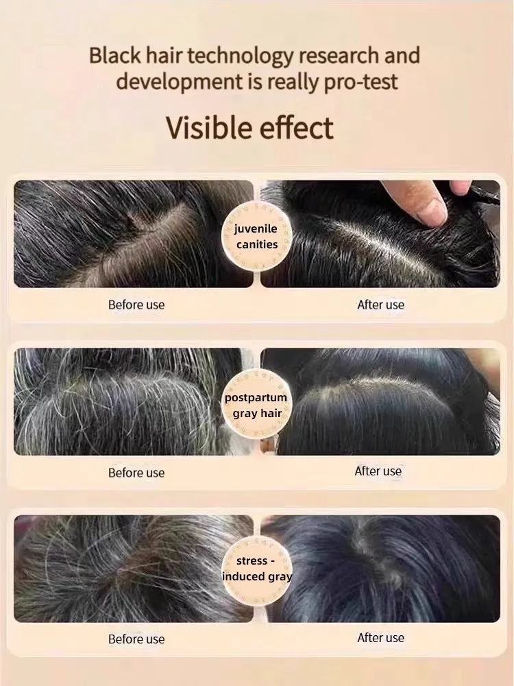 Polygonum Multiflorum Shampoo 5