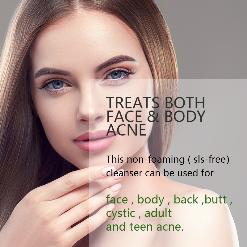 OEM ODM Organic Herbal Vegan 10% Benzoyl Peroxide Acne Treatment Cream Cleanser Deep Clean Pore Scrub Oil Control Dry Skin