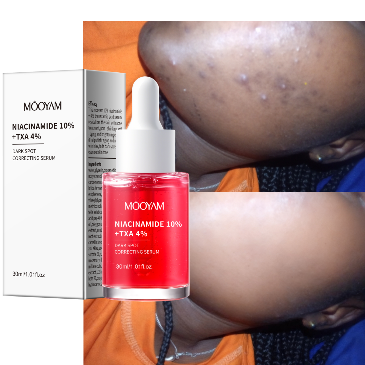 Private Label OEM Niacinamide 10%+Txa 4% Dark Spot Correcting Serum Anti-aging Brightening Reduce Wrikles MOOYAM Facial Serum