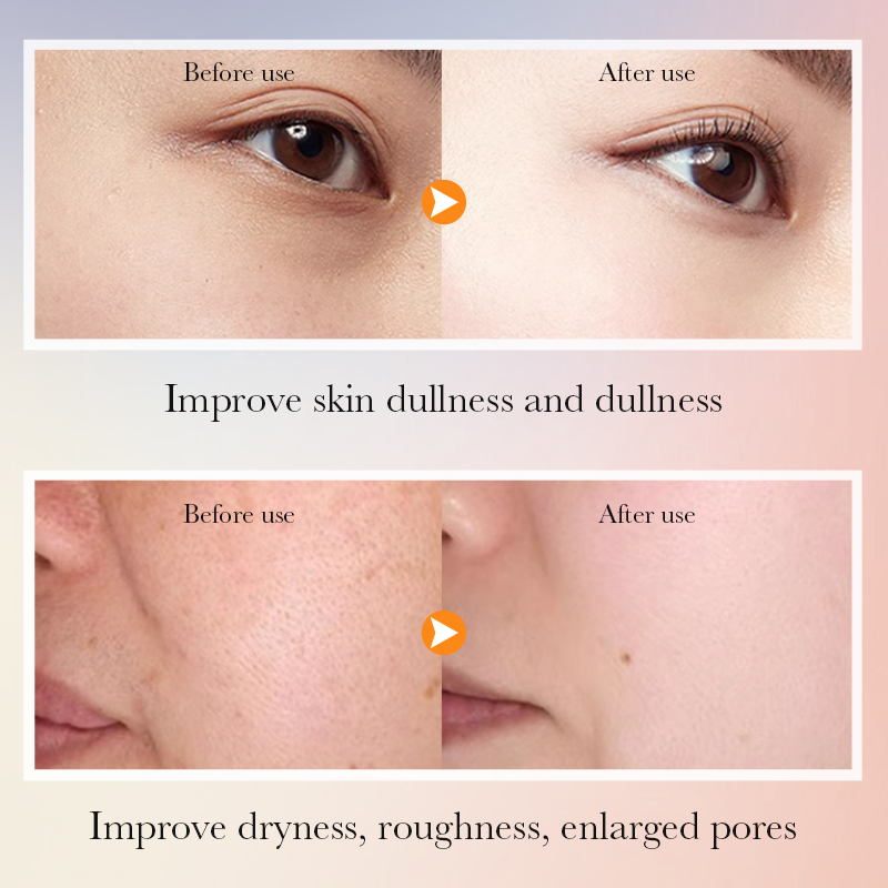 SADOER OEM Private Label Multi-Effect Repair Beauty Kit Korea Whitening Brightening Vitamin C Skin Care Set