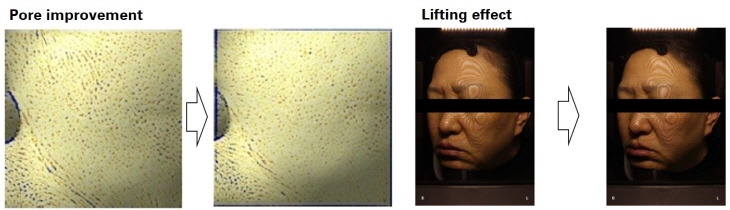 Clinical Results 2