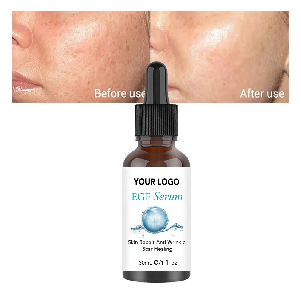 Hot Selling Best Face Serum Vegan Face Serum Private Label Whitening Lightening Egf Face Serum
