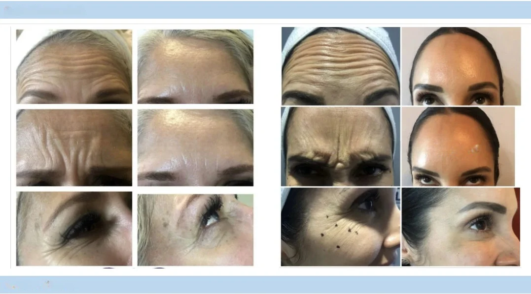 Biotech Cosmetic Product
