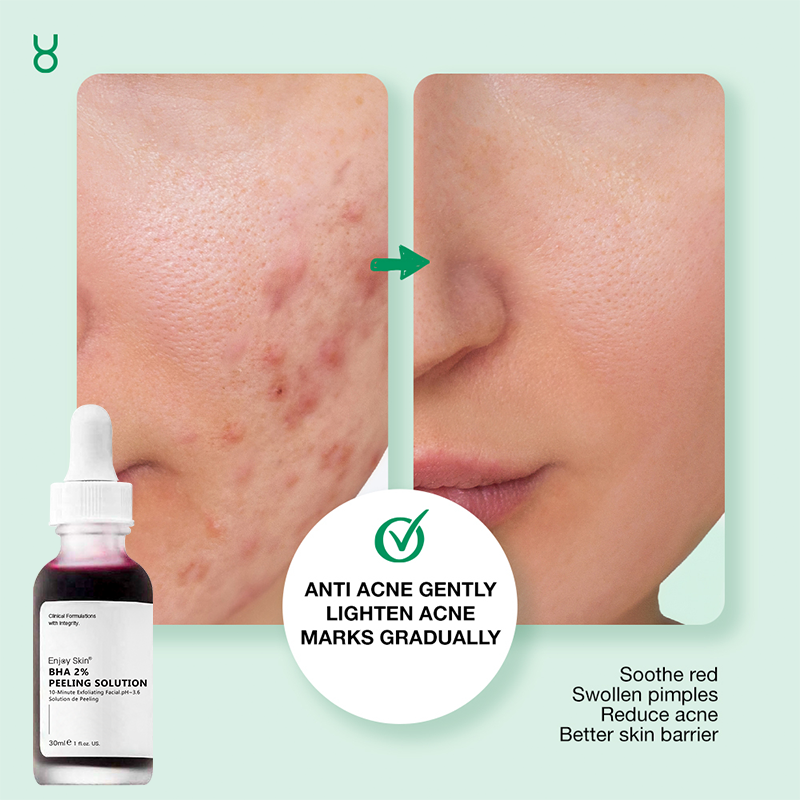 Enjoy Skin Whitening Skin Face Care Hyaluronic Acid BHA Peeling Solution with Niacinamide Serum
