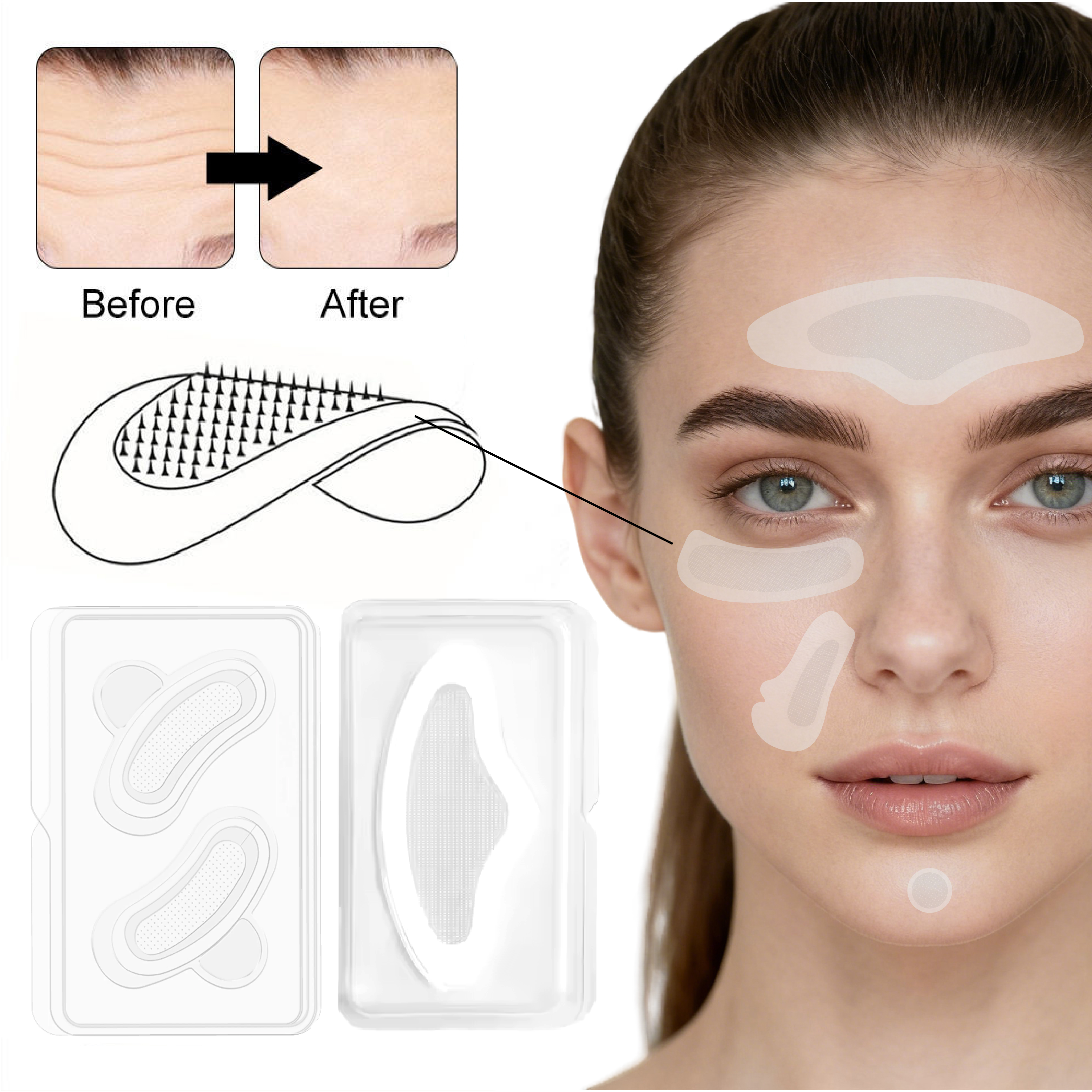 Private Label Micro Point Acne Patches For Face Acne Treatment Anti Acne Patch Spot Remover Microdart Pimple Patch