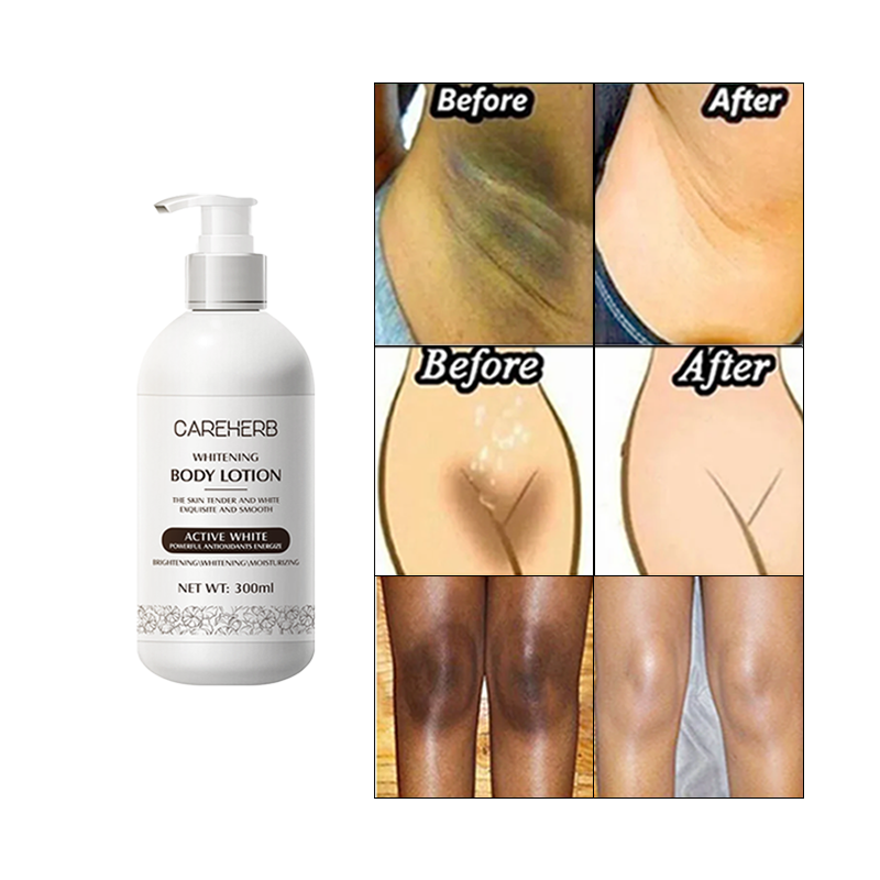 Halal Custom Logo Organic Nourishing Refreshing Bleaching Body Cream Skin Moisturizing Whitening Body Lotion for Adults