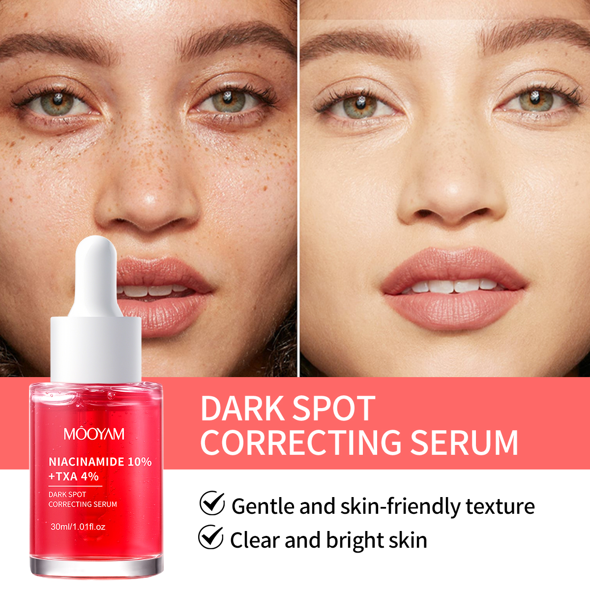 Private Label OEM Niacinamide 10%+Txa 4% Dark Spot Correcting Serum Anti-aging Brightening Reduce Wrikles MOOYAM Facial Serum