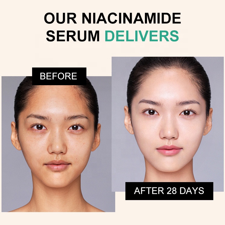 OEM ODM Custom Facial Serum Brightening Niacinamide Hyaluronic Acid Serum with Niacinamide