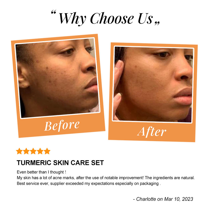 Private Label Brightening Skincare Anti Acne Dark Spot Turmeric Facial Kit Anti Aging Tumeric Skin Care Set
