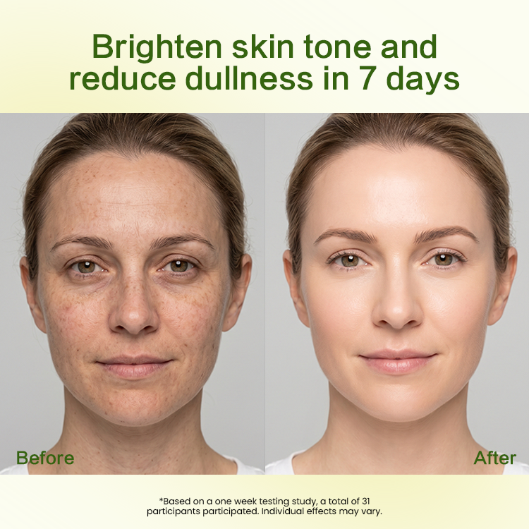 Wholesale Face Care Serum Hyaluronic Acid Natural Vitamin C Green Tangerine Extract Niacinamide Arbutin Centella Asiatica