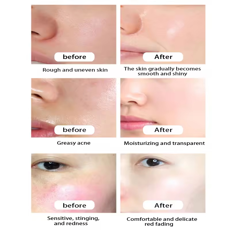 Private Label 8pcs/set Face Rice Skin Care Set Whitening Hydrating Anti Wrinkle Organic Cosmetics Beauty Facial Skincare Kit